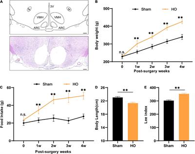 Microglial infiltration mediates cognitive dysfunction in rat models of hypothalamic obesity via a hypothalamic-hippocampal circuit involving the lateral hypothalamic area